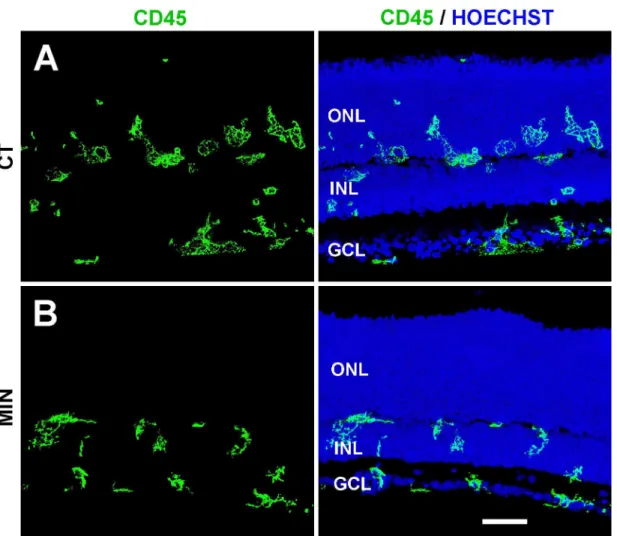 Fig 2. Microglial distribution in minocycline-treated and untreated explants. The left panel shows microglial cells (stained with anti-CD45 antibody, green), whereas the right panel depicts both microglial cells and the location of retinal layers (revealed