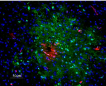 Fig. 2. Immunofluorescence staining to detect IgY leakage in EB perfused and fresh frozen brain sections