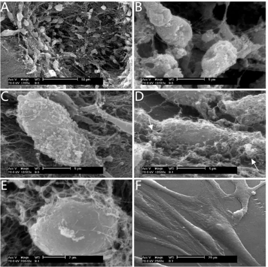 Figure 8. SEM images keratocytes at day 4 of culture. The growth of keratocytes under SMG (A–D): the cellular aggregation in a pore of the carrier (A); round shape and 3D interconnection of cells (B); cells with rough surfaces rich in globular prominences 