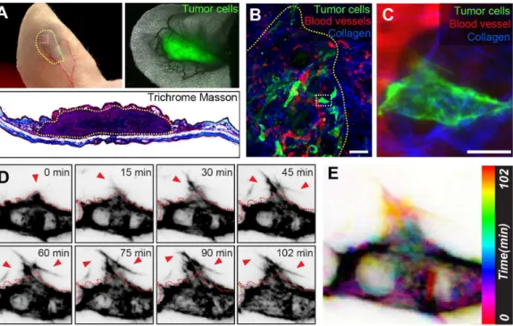 Figure 3. Full Volume Correlation of the ROI. A. 3D view of a 2PEM z-stack of mouse ear tissue, 7 days post-injection with GFP-expressing tumor cells (green)