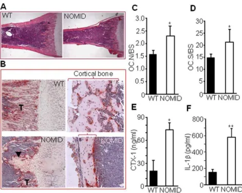 Figure 6. Bone resorption is increased in NOMID mice. Femoral sections from P13 mice were stained with H&amp;E (A) or for TRAP activity (B–D), and OC number (C) or surface (D) per bone surface was determined
