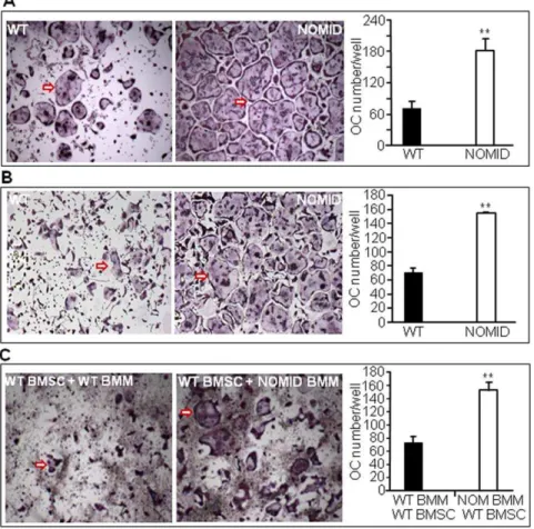 Figure 8. OC differentiation is increased in NOMID cells. Unfractionated bone marrow cells (A) or BMM previously cultured for 3 days in the presence of M-CSF (B) were induced to differentiate into OC in the presence of M-CSF and 100 ng/ml RANKL