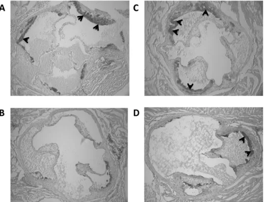 Fig 3. Representative images of aortic sinus in control and Nx apoE-/- mice undertaking voluntary exercise stained with Oil Red O (depicted as darker areas and indicated with arrows)