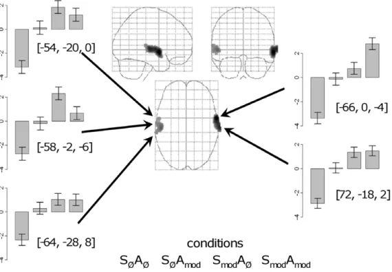 Figure 2. Neural activation revealed by the additive effects contrast S mod A mod .(S mod A Ø and S Ø A mod ).S Ø A Ø 