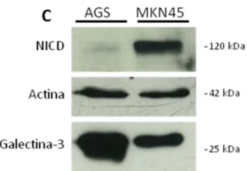 Figura  2.  Expressão de galectina-3 e Notch estão  inversamente correlacionados. Análise por PCR em  tempo real da expressão de galectina-3 (A) e do  receptor Notch-1 (B) para as linhas AGS e MKN45