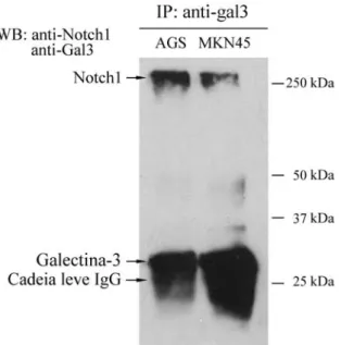 Figura  10.  O receptor Notch-1 interage com galectina-3. Extracto celular das linhas AGS e MKN45 foram incubados  com anticorpo anti-gal-3 (M3/38)