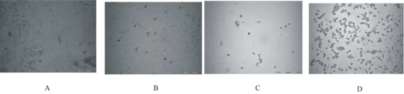 Figure 5. TEM images of lysozyme under different incubation conditions: images (A), (B), (C) and (D) are those for lysoyme solution incubated at 57 6 C in presence of L-proline, 4-hydroxy L-proline, sarcosine and TMAO respectively.