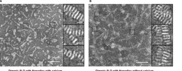 Fig 6. 5LO dimers cannot bind on nanodiscs as shown by the extensive stacking after staining by PTA
