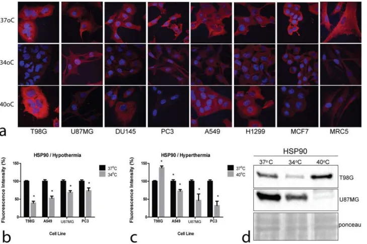 Figure 4. Confocal immunofluorescent microscopy and western blot images of HSP90. 4a: Representative confocal microcopy images showing cytoplasmic HSP90 expression changing intensity after exposure to hypothermia (34°C) or hyperthermia (40°C) compared to n