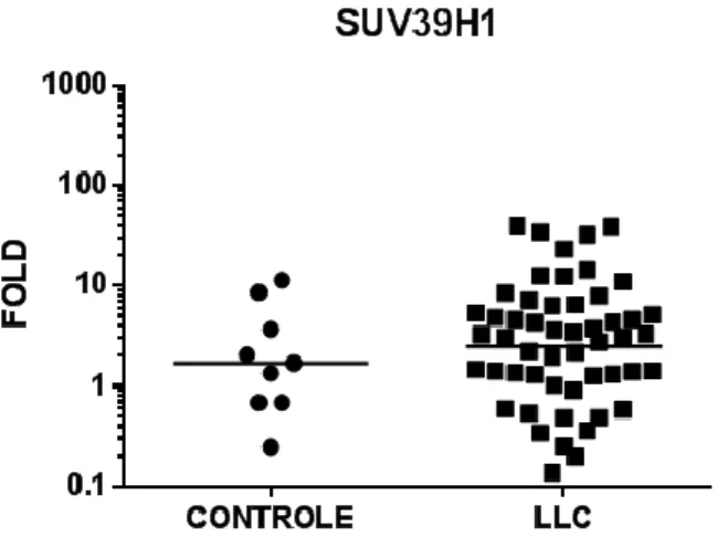 Figura 3: Expressão do gene SUV39H1 na LLC.A expressão do gene foi realizada em amostras de LLC e  em  células  B de pacientes  saudáveis,  pela  técnica  de  PCR