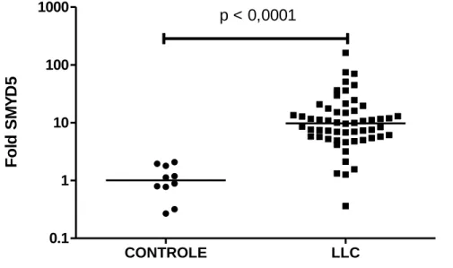 Figura 10: Comparação entre a expressão de SMYD5 em Linfócito B normais e na LLC por PCR em  tempo  real