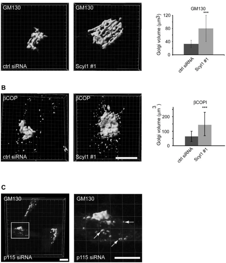 Figure 2. The volume of the Golgi is increased following Scyl1 knock down. A, HeLa cells transfected with control (ctrl) or Scyl1 #1 siRNA were stained for GM130