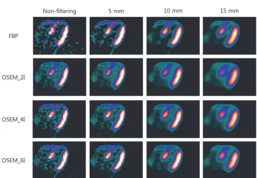 Figure 1.    N‐N(  cardiac PET image was reconstructed by FBP and OSEM. OSEM reconstruction method was divided into OSEM_ ),  OSEM_ ), and OSEM_ ), since the number of iterations was set to  ,  , and  