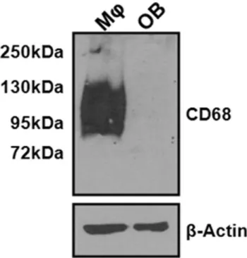 Figure 6. CD68 is not expressed by osteoblasts. CD68 and b-actin expression in mouse BMMs(MQ) cultured with 220 ng/mL M-CSF and cultured mouse calvarial osteoblasts (OB) was determined by Western immunoblotting