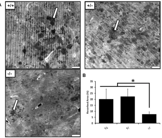 Figure 7. CD68 2/2 osteoclasts do not efficiently resorb bone. BMMs from CD68 +/+ , +/2 , and 2/2 mice were seeded onto bovine cortical bone slices and differentiated into osteoclasts over 4 days