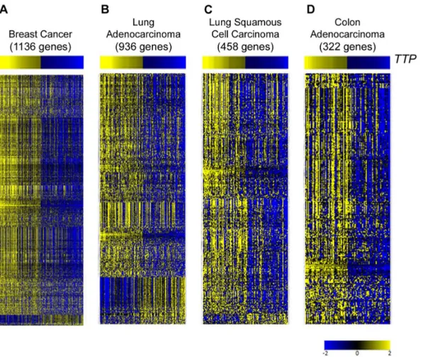 Fig. 1. Differentially expressed genes between tumors in TCGA datasets with high and low expression of TTP 