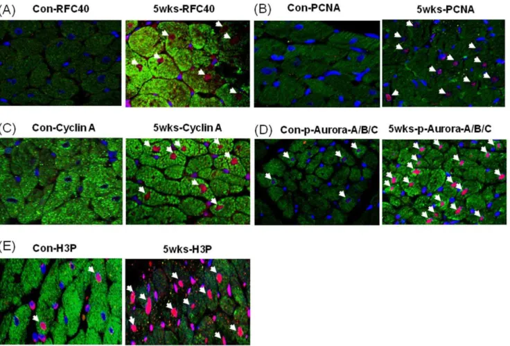 Figure 4. Immunohistochemical analyses revealed RFC40, PCNA, Cyclin A, phosphor-Aurora A/B/C kinase and pHis3 positive CMs nuclei in hypertrophied RV