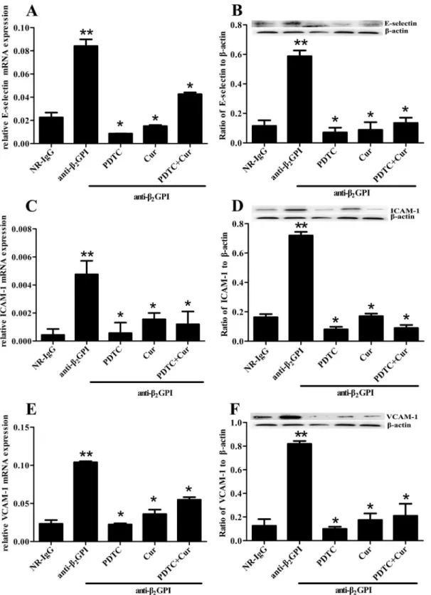 Fig 4. Inhibition of anti-β 2 GPI-induced E-selectin, ICAM-1 and VCAM-1 expression by PDTC or/and Curcumin