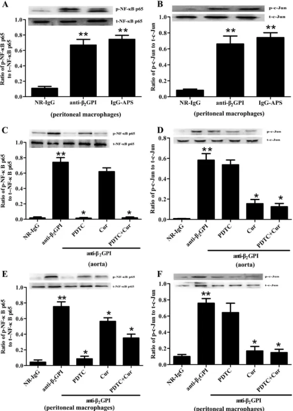 Fig 1. The effects of PDTC and Curcumin on anti-β 2 GPI-mediated NF-κB and AP-1 phosphorylation