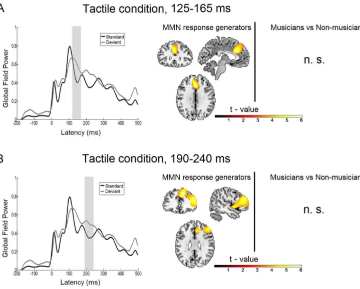 Figure 4. Statistical parametric maps and grand averaged global field power of the tactile MMN response