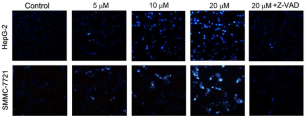 Fig. 3. Nuclear morphology of HepG2 and SMMC7721 cells treated with 5, 10, and 20 mM abieslactone or 20 mM Z-VAD-FMK for 24 h was determined by staining with Hoechst 33258.