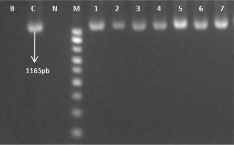 Figura 7 - Electroforese em gel de agarose (1,5%) do produto de PCR do gene ciaB