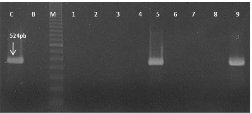 Figura 8 - electroforese em gel de agarose do produto de PCR do gene cgtB