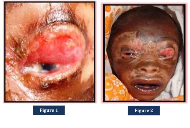 Figure 1 Figure 2 