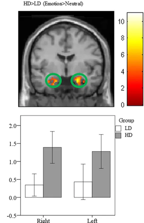Fig 4. Statistical parametric maps for amygdala region-of-interest (ROI). Post-hoc independent sample t-tests using ROI analysis revealed heightened response in the bilateral amygdala for the HD > LD