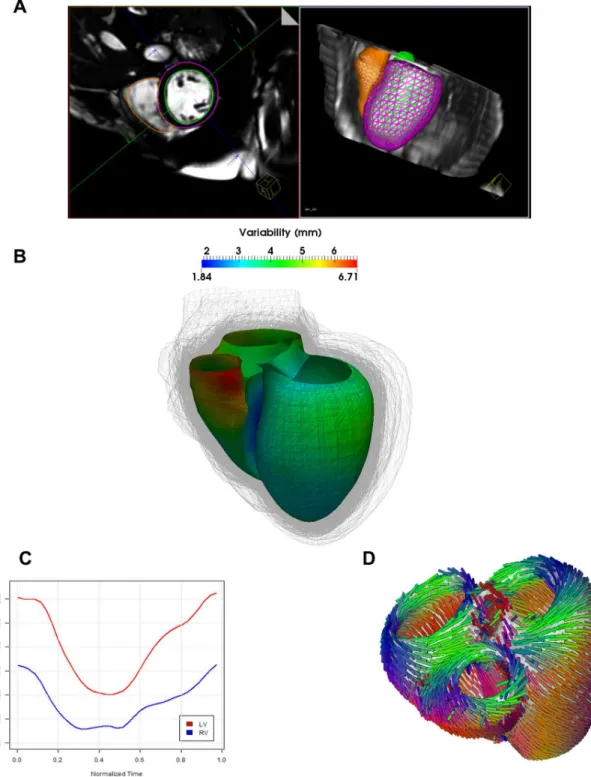 Fig 2. Automated estimation of the 3D anatomical model. A) Automatic segmentation of the right and left ventricle