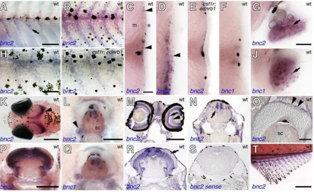 Figure 6. bnc2 and bnc1 expression in diverse tissues during the larval-to-adult transformation