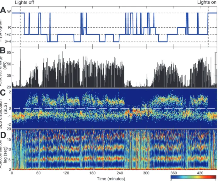 Fig 4. Example of whole night recording and main features. (A) Hypnogram determined by PSG