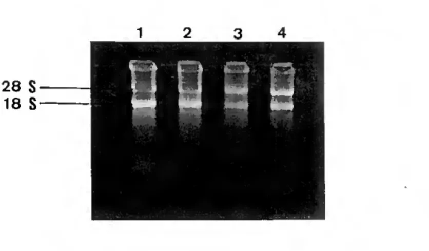 Figura 1-6 - Electroforese das amostras de RNAtotal 1, 2, 3 c 4 respectivamente nas pistas 1, 2, 3 e 4