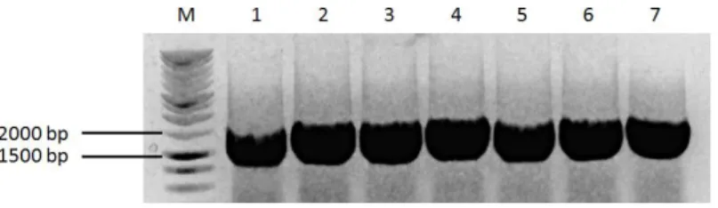 Figura  9  –  Amplificação  do gene  LinJ19_V3.1490  (1755  pb)  por  PCR  a  partir  de  7  colónias  de  bactérias  DH5α  transformadas,  escolhidas  aleatoriamente
