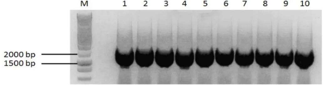 Figura 11 – Amplificação do gene LinJ19_V3.1490 (1755 pb) por PCR, a partir de 10 colónias de bactérias  BL21-CodonPlus, transformadas com o DNA plasmídico