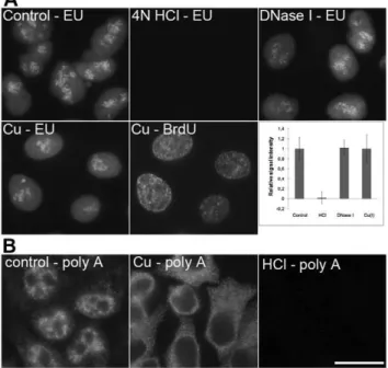 Figure 8. A comparison of the methods based on HCl, DNase I and copper(I) ions. A) The detection of the EU signal in non-treated cells (control; the cells were just fixed and permeabilized without any additional treatment), cells treated with 4N HCl, DNase