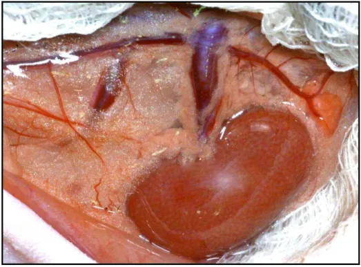 Figura 1 - Acesso transperitoneal do rim esquerdo; incisão abdominal mediana 