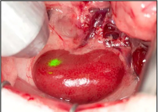 Figura 6 - Aplicação laser após reperfusão completa do córtex renal 