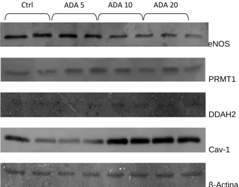 Figura 8 – Efeito da incubação de HUVEC com ADA na expressão proteica. Análise por Western blot de eNOS, PRMT1,  DDAH2, Cav1 e β-actina em HUVEC incubadas durante 24horas com meio controlo (ctrl) ou de teste (concentrações de  ADA de 5, 10 e 20 µM))