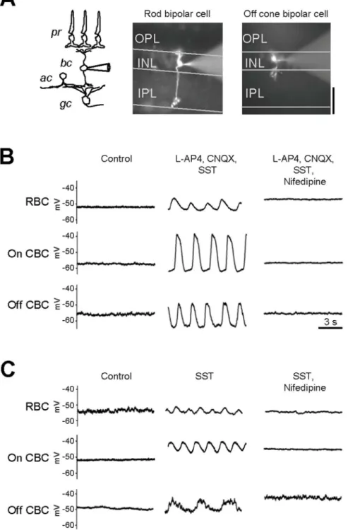 Figure 1. Synaptic inputs suppress regenerative activity in adult retinal bipolar cells
