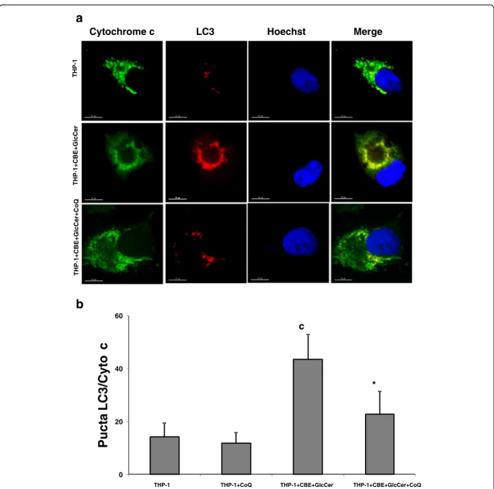 Fig. 7 Colocalization of autophagosome and mitochondria markers in chemically-induced Gaucher macrophages