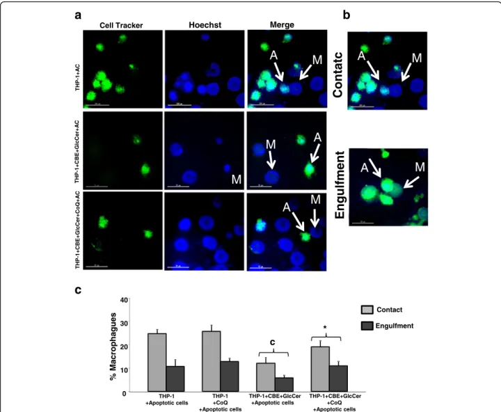 Fig. 9 Defective efferocytosis in chemically-induced Gaucher macrophages. a Representative fluorescence images of CellTracker ™ Green-labelled control and apoptotic H460 cells interacting with control and chemically-induced Gaucher macrophages (M)
