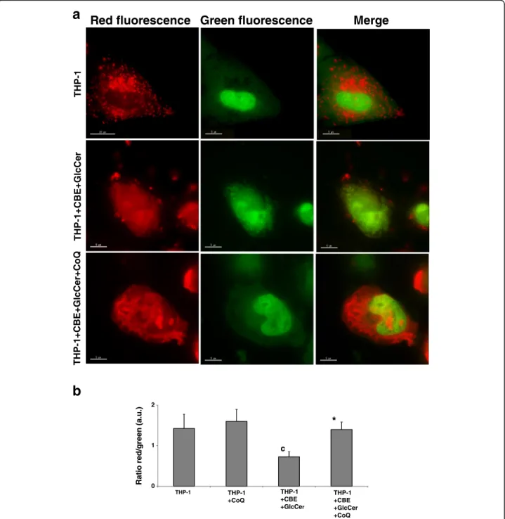 Fig. 5 Lysosome acidification impairment in chemically-induced Gaucher macrophages. a Representative fluorescence images of THP-1 macrophages cultured for 72 h with CBE + GlcCer (2,5 mM + 200 μ M) in the presence of CoQ (25 μ M), and stained for 15 min wit