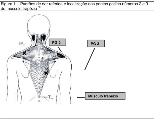 Figura 1 – Padrões de dor referida e localização dos pontos gatilho números 2 e 3 do músculo trapézio  50
