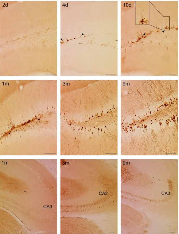 Fig 5. Dynamic changes in the pattern of labeled cells mirror the neurogenic cascade in the DG
