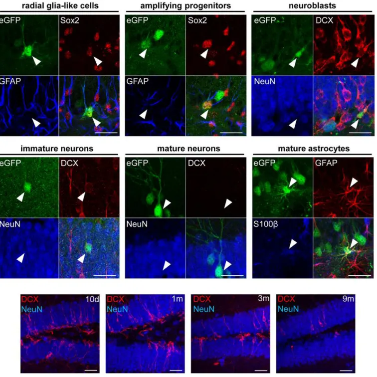 Fig 6. Phenotypical analysis of different labeled cell types in the DG. Upper and middle panel: Triple fluorescent stainings for eGFP/Sox2/GFAP, eGFP/