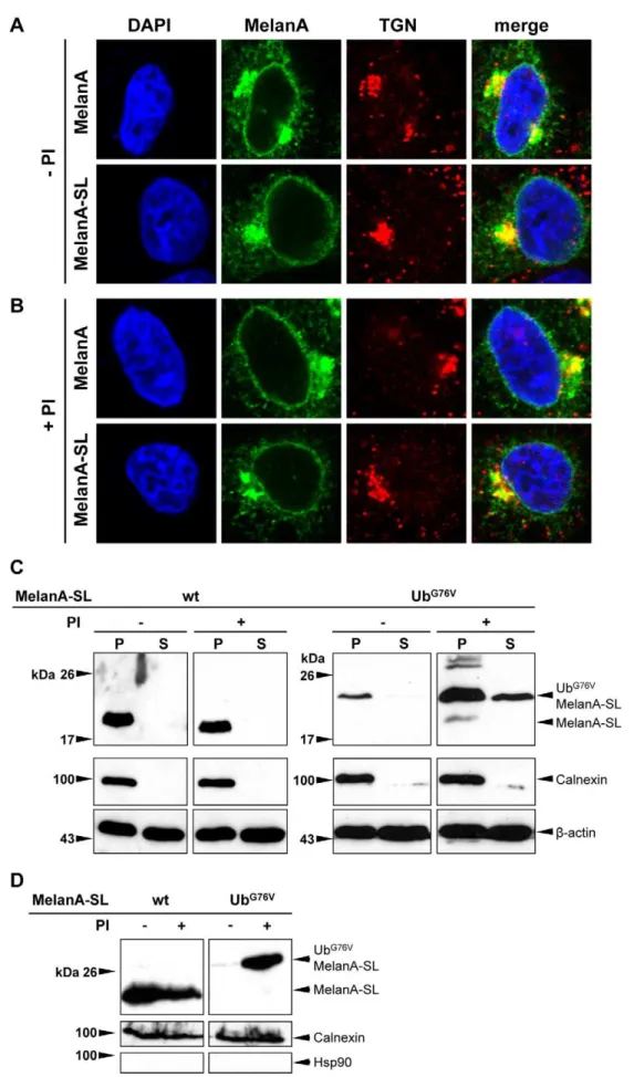 Figure 2. Insertion of SL does not affect the subcellular localization of MelanA. Following transient transfection HeLa cells expressing MelanA or MelanA-SL were treated with (A) DMSO as a solvent control or (B) PIs (20 mM MG-132+5 mM LC) for 4 h