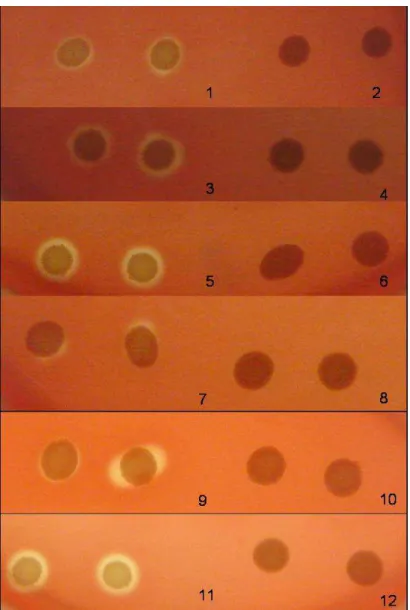 Figura 3.  Figura comparativa do ensaio hemolítico realizado em placas de ágar  sangue  dos  isolados  quando  expressaram  perfil  hemolítico  e  não  hemolítico: 1 e 2
