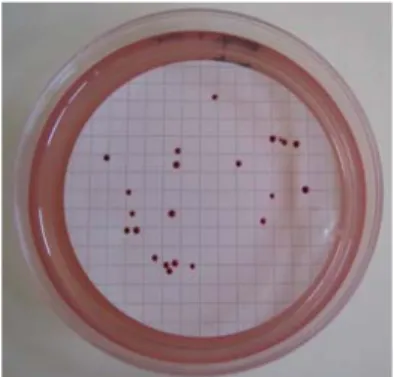 Figura 3.6 – Colónias típicas em meio de cultura selectivo Slanetz &amp; Bartley Agar,  após incubação a (36.0±2.0)ºC durante (44±4)h