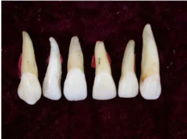 Figura 4.1 - Dentes selecionados 